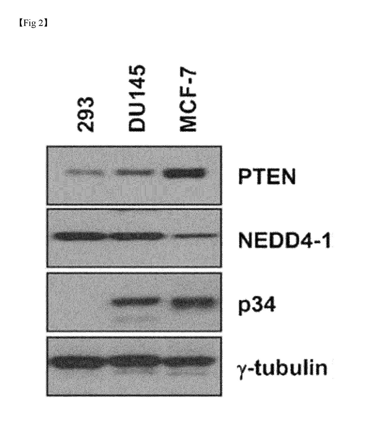 Composition for treatment or metastasis suppression of cancers which includes p34 expression inhibitor or activity inhibitor as active ingredient