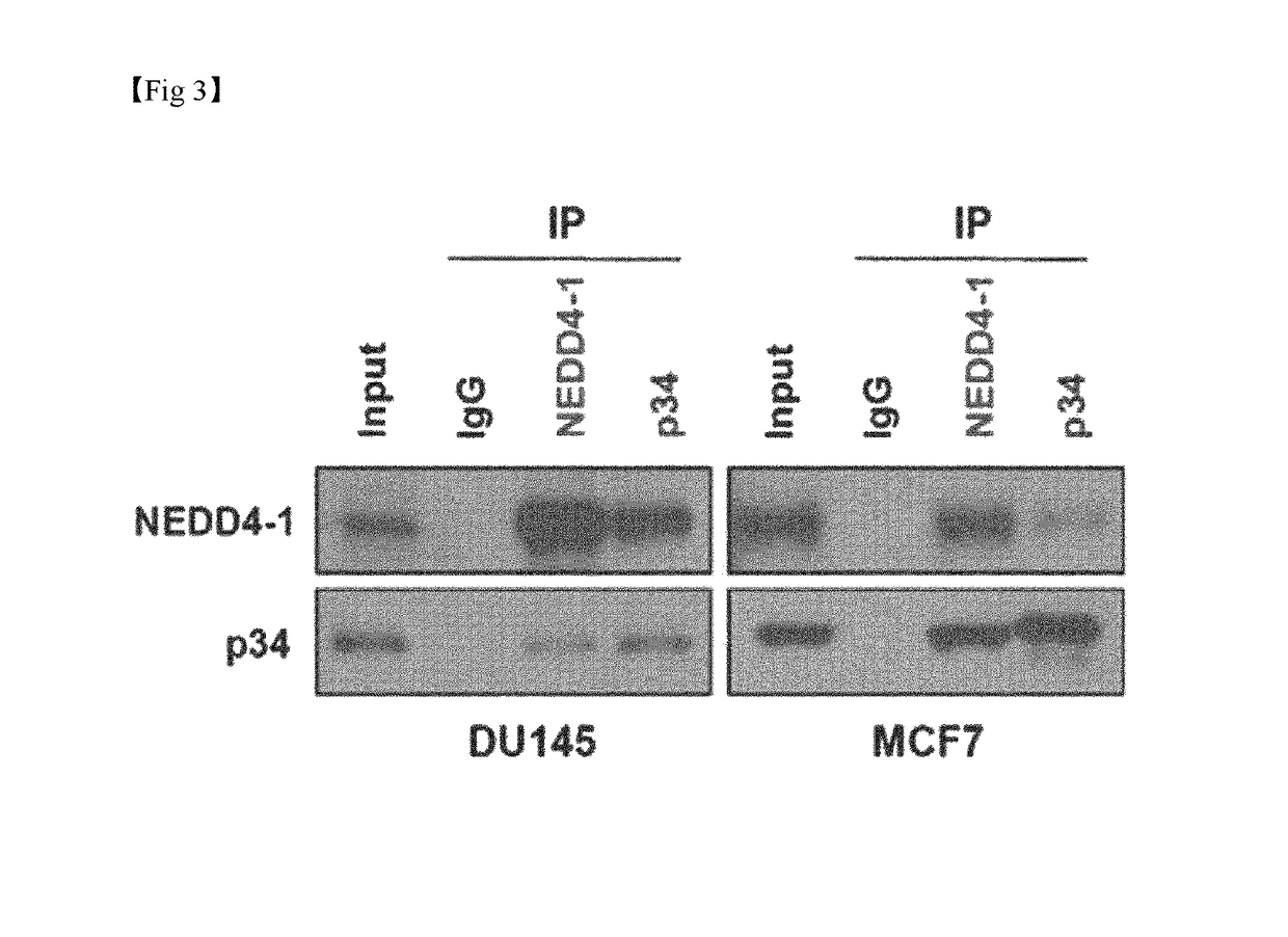 Composition for treatment or metastasis suppression of cancers which includes p34 expression inhibitor or activity inhibitor as active ingredient