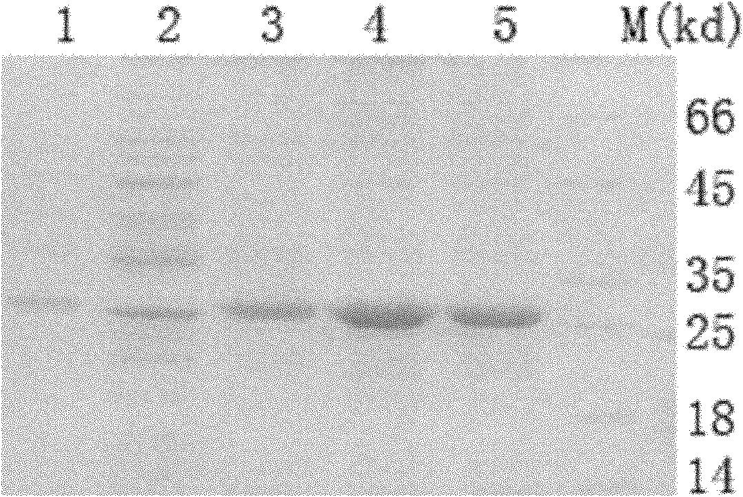 Recombinant oxyntomodulin (OXM) fusion protein, and preparation and application thereof