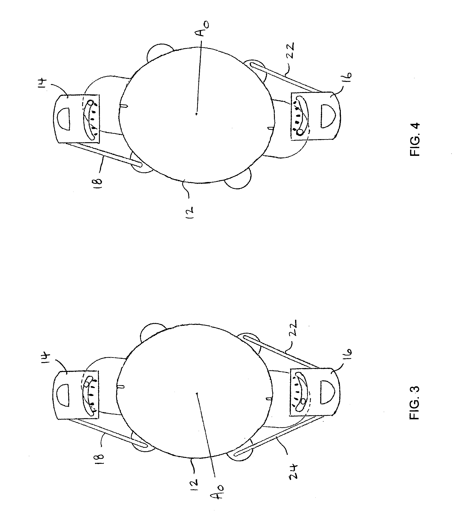 Adjustable Toric Intraocular Lens