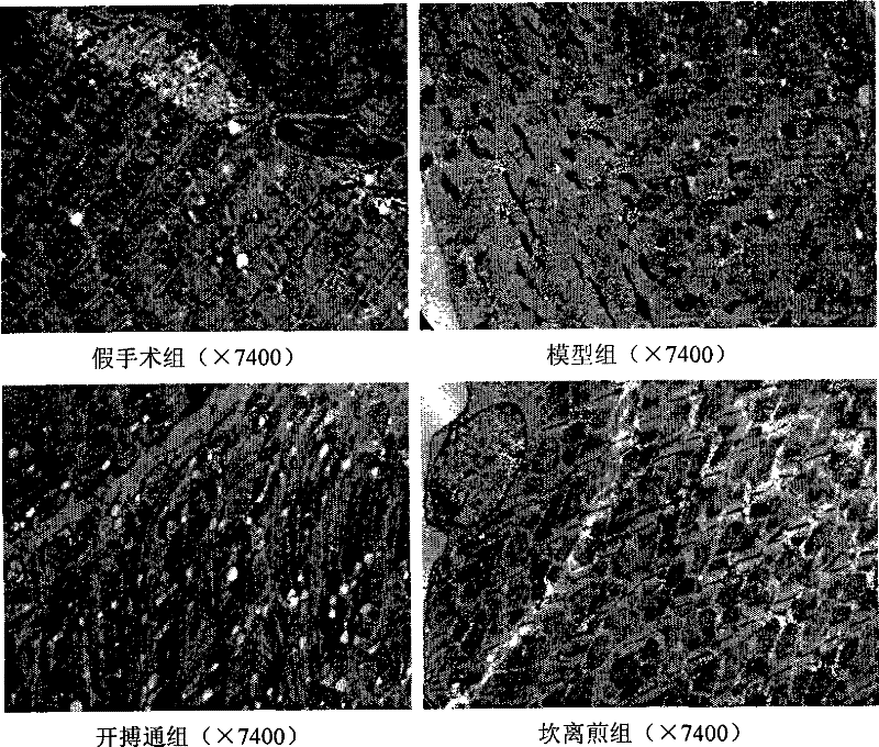 Anti-heart failure pharmaceutical composition for improving skeletal muscle function and preparation method thereof