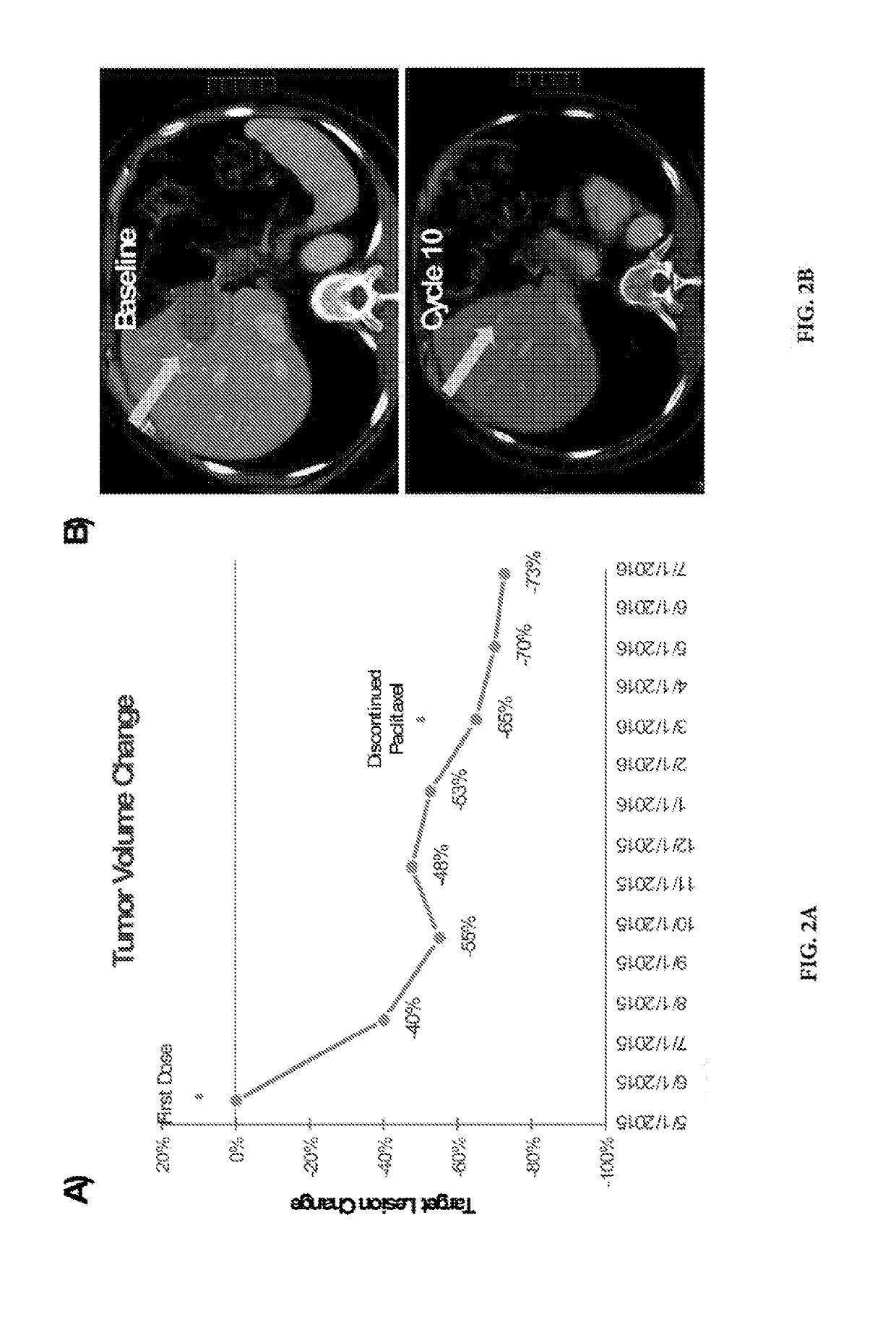 Use of beta-catenin as a biomarker for treating cancers using Anti-dkk-1 antibody