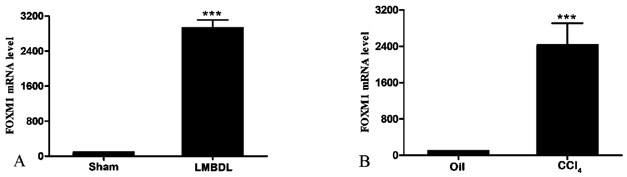 Application of FOXM1 inhibitor FDI-6 in resistance of hepatic fibrosis