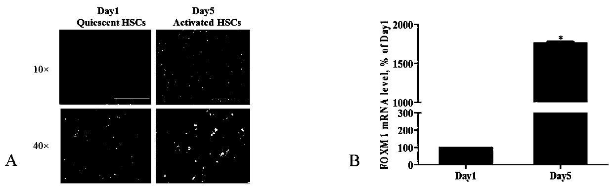 Application of FOXM1 inhibitor FDI-6 in resistance of hepatic fibrosis