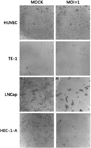 Coxsackievirus for treating tumor