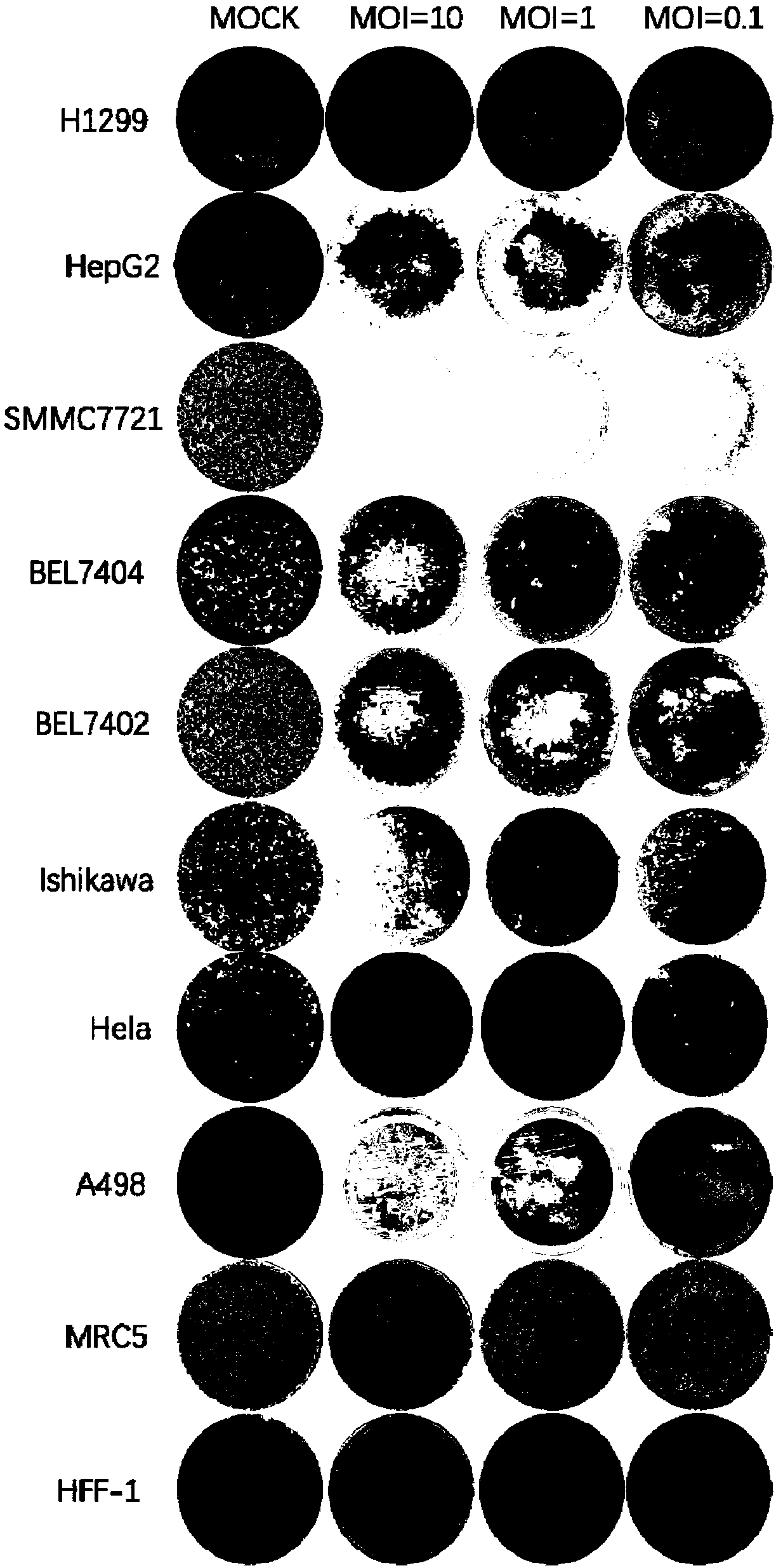 Coxsackievirus for treating tumor