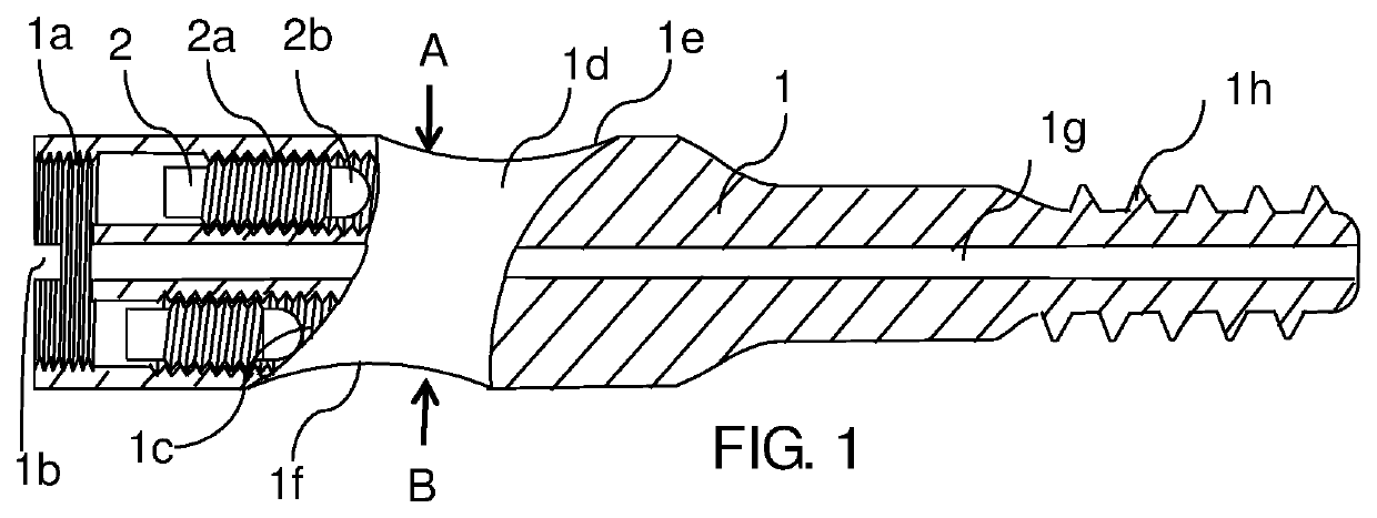 Intramedullary nailing system of variable angle to treat femur fractures