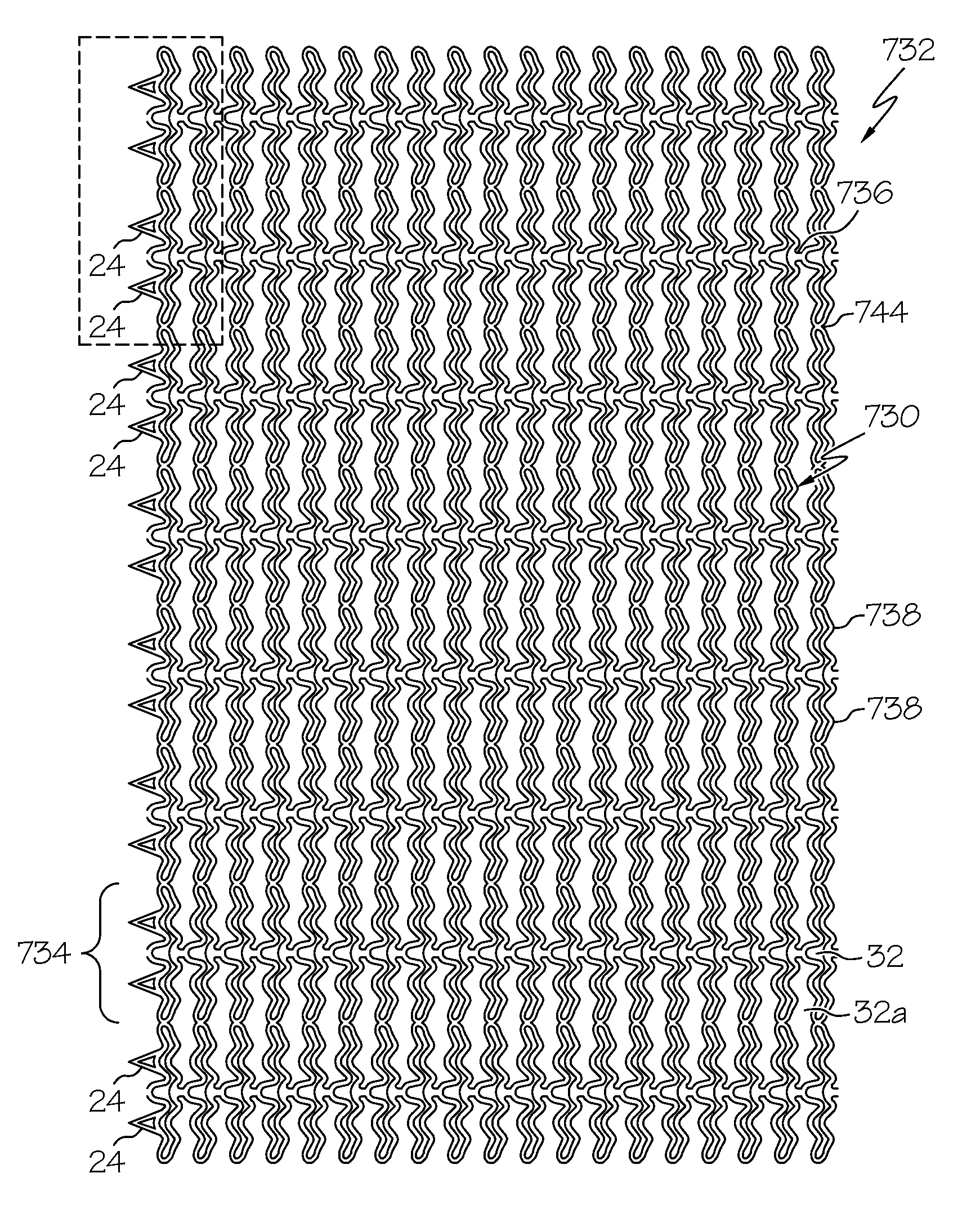 Stretchable anti-buckling coiled-sheet stent