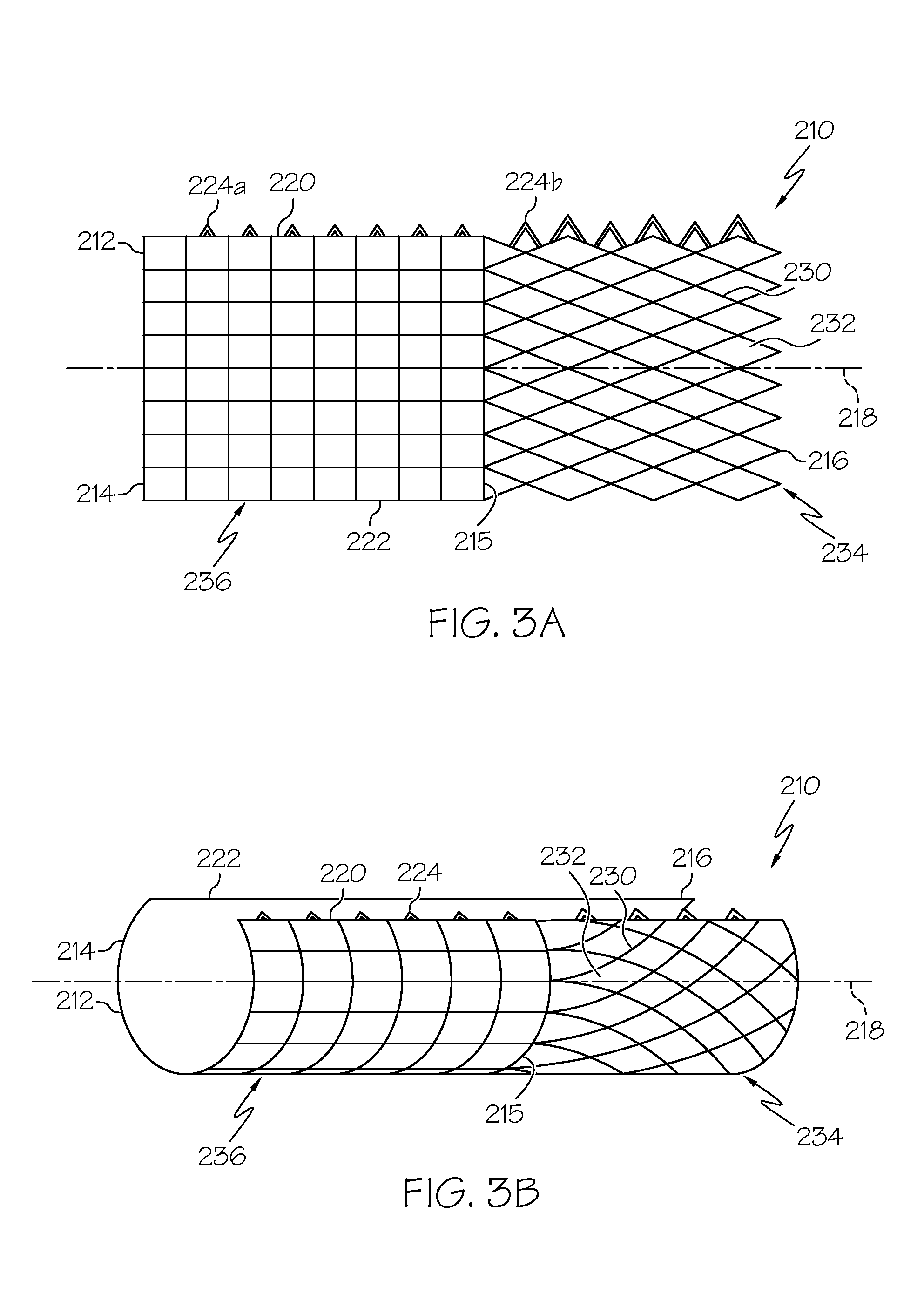 Stretchable anti-buckling coiled-sheet stent