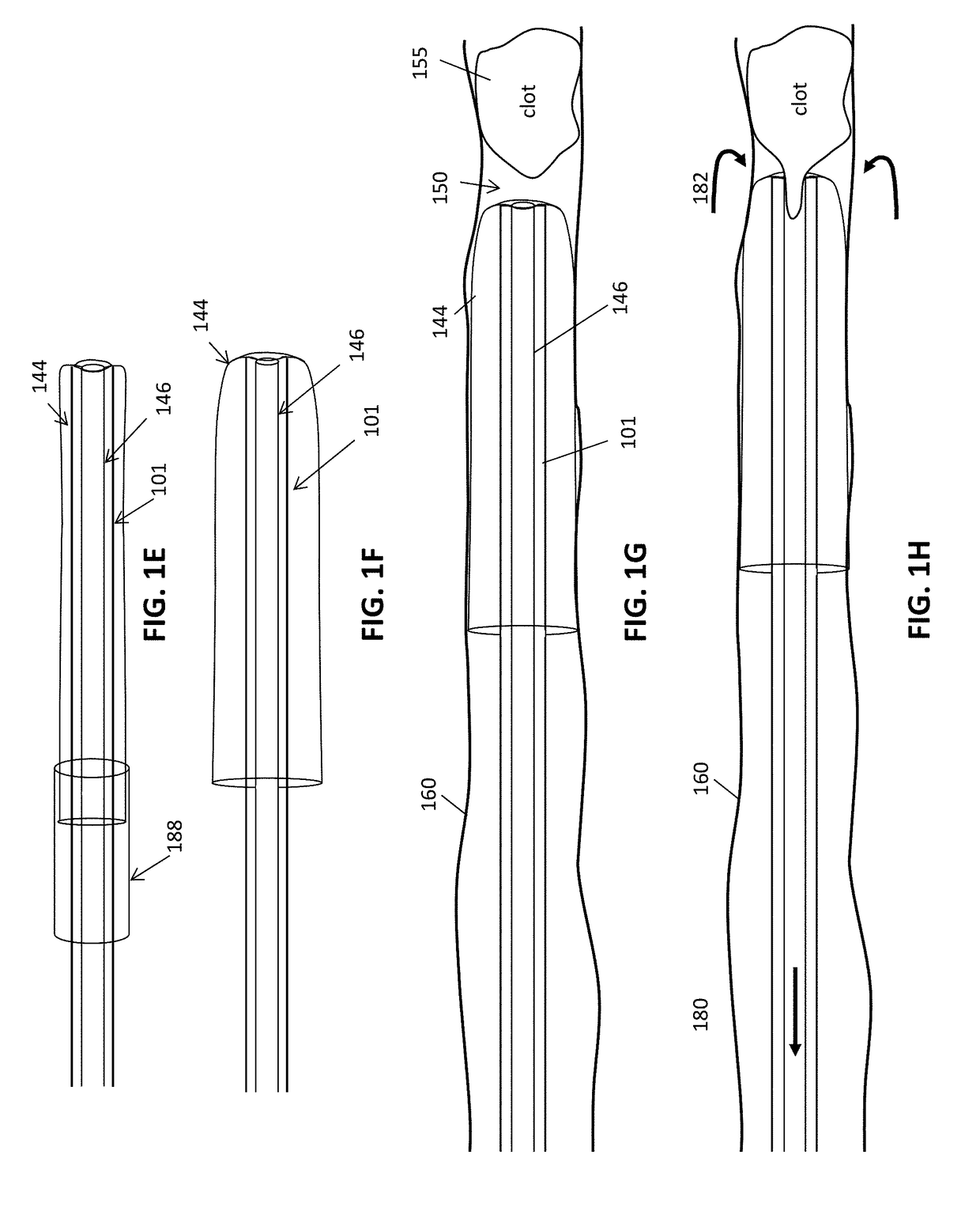 Methods for advancing inverting mechanical thrombectomy apparatuses in the vasculature