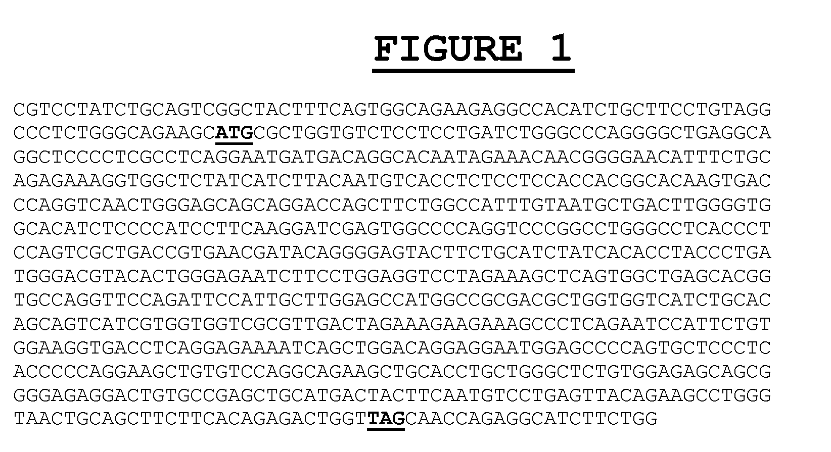 Composition and methods for the diagnosis of immune related diseases involving the PRO52254 polypeptide