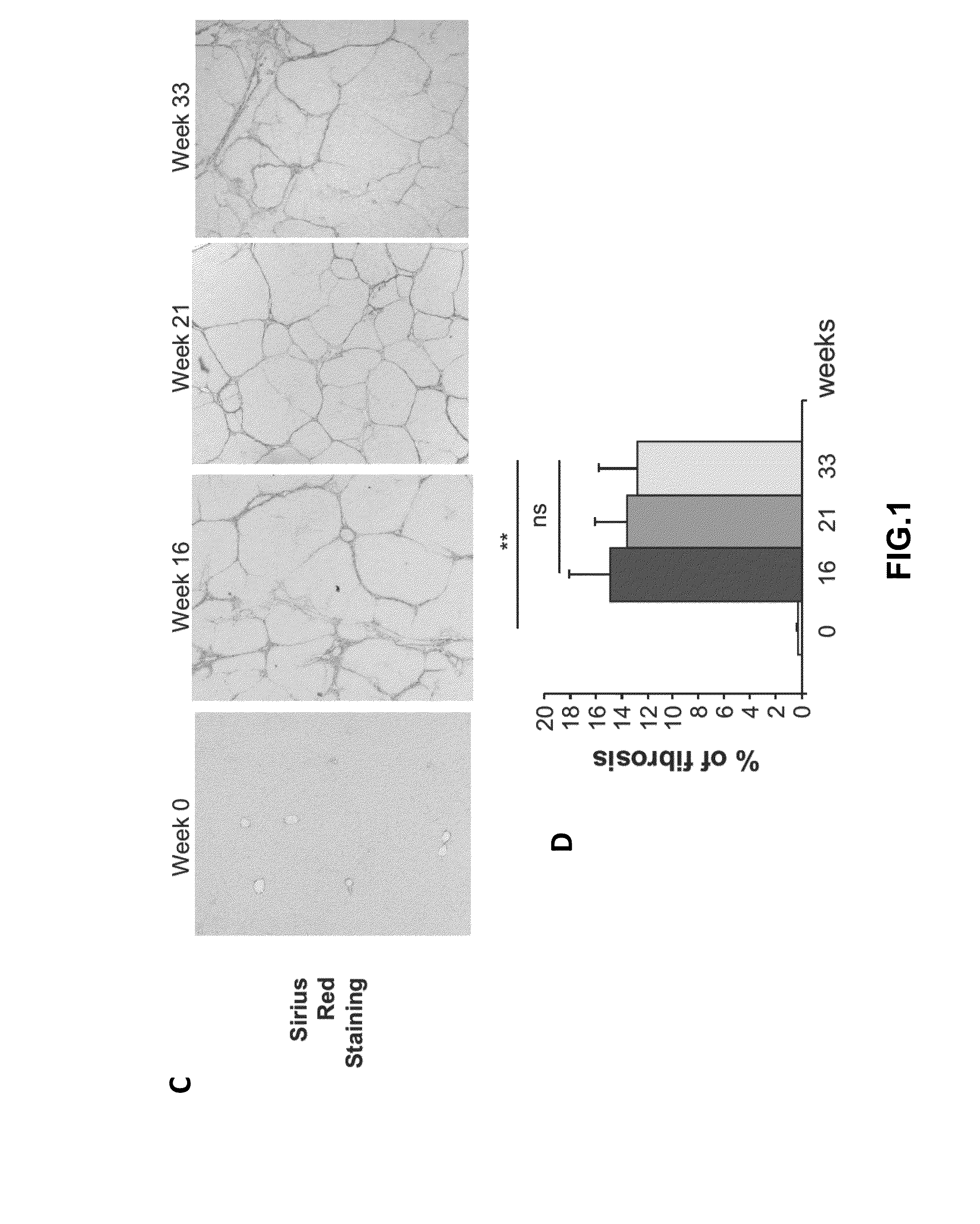 Methods and compositions for the treatment of cirrhosis and liver fibrosis