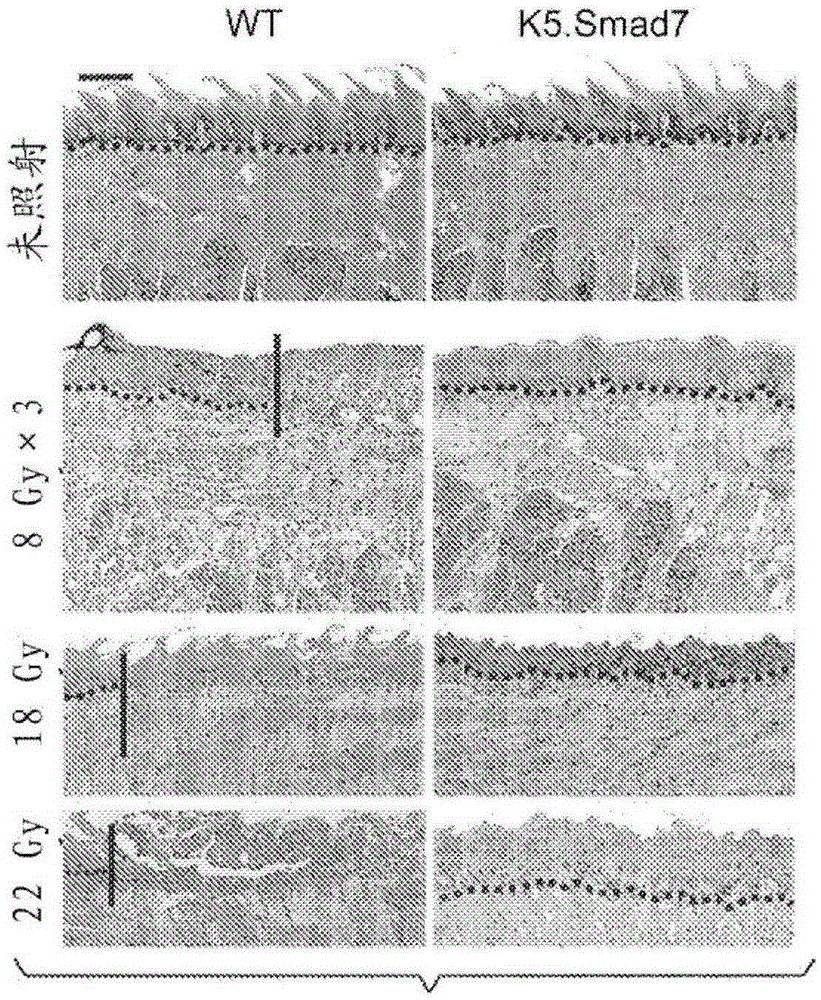 PTD-SMAD7 therapeutics