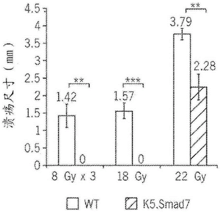 PTD-SMAD7 therapeutics