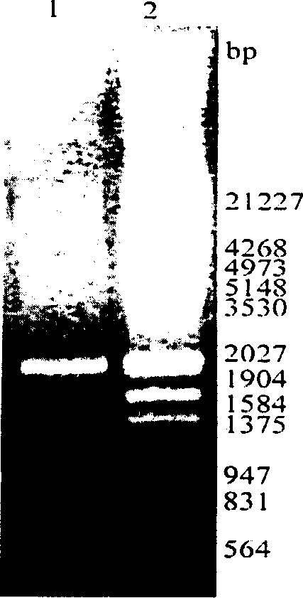 Method for producing blood vessel diseases gene medicine-blood vessel endothelium growth gene-2 naked DNA by microorganism cloning vehicle