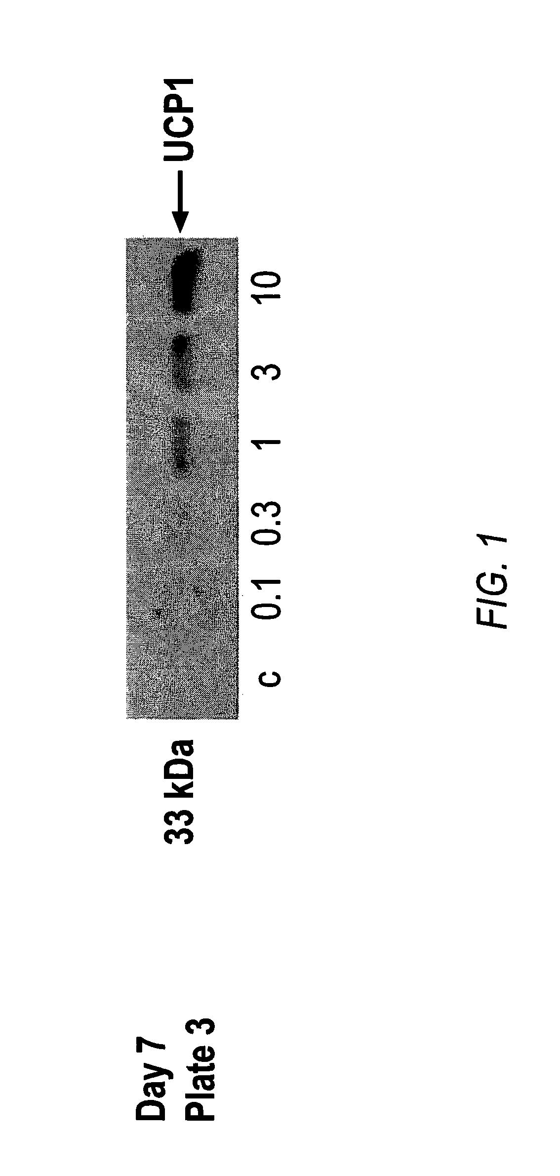 Ppar-sparing thiazolidinediones and combinations for the treatment of obesity and other metabolic diseases