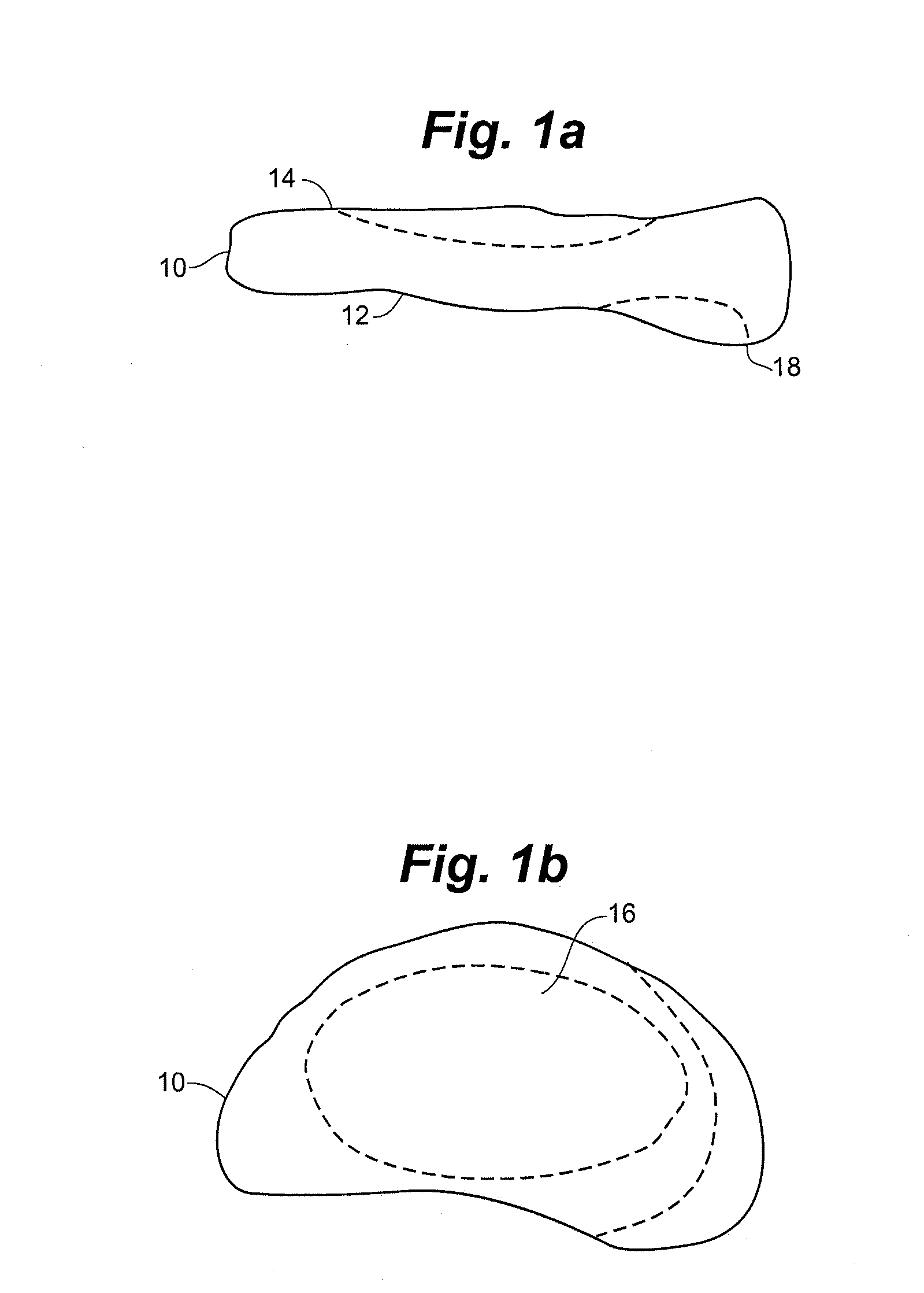 Method and system for mammalian joint resurfacing