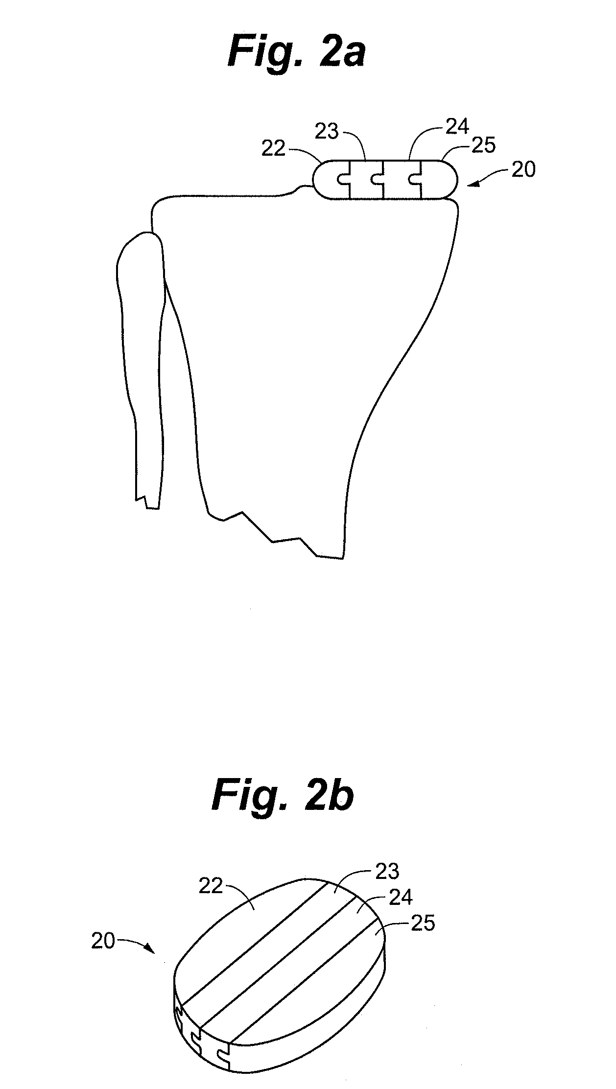 Method and system for mammalian joint resurfacing