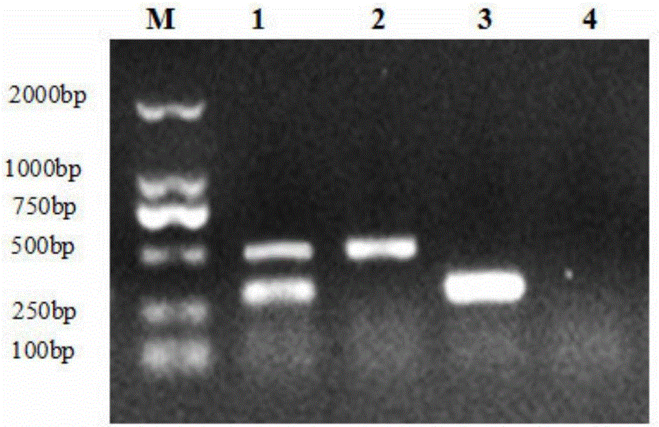 Duck plague and escherichia coli dual PCR diagnostic kit