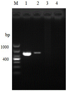 A set of universal detection primers and kits for microsporidia molecules