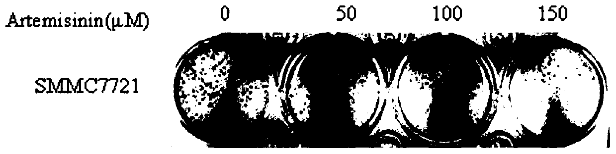 Application of artemisinin in preparation of drugs to treat c-myc/mTOR-activated human hepatoma SMMC7721 cells