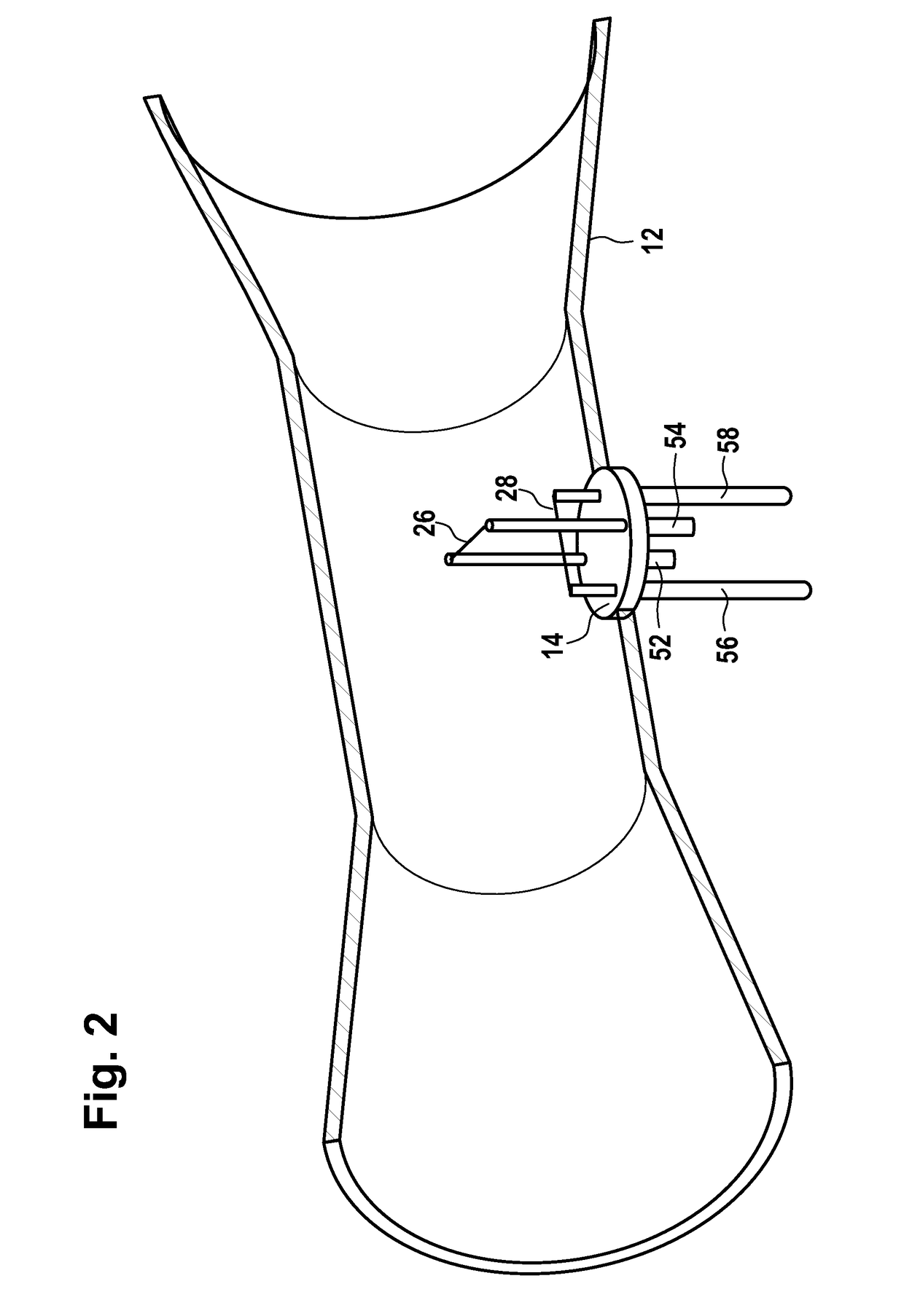 Anesthesia apparatus or ventilator with a hot wire sensor, hot wire sensor and hot wire sensor module for a hot wire sensor