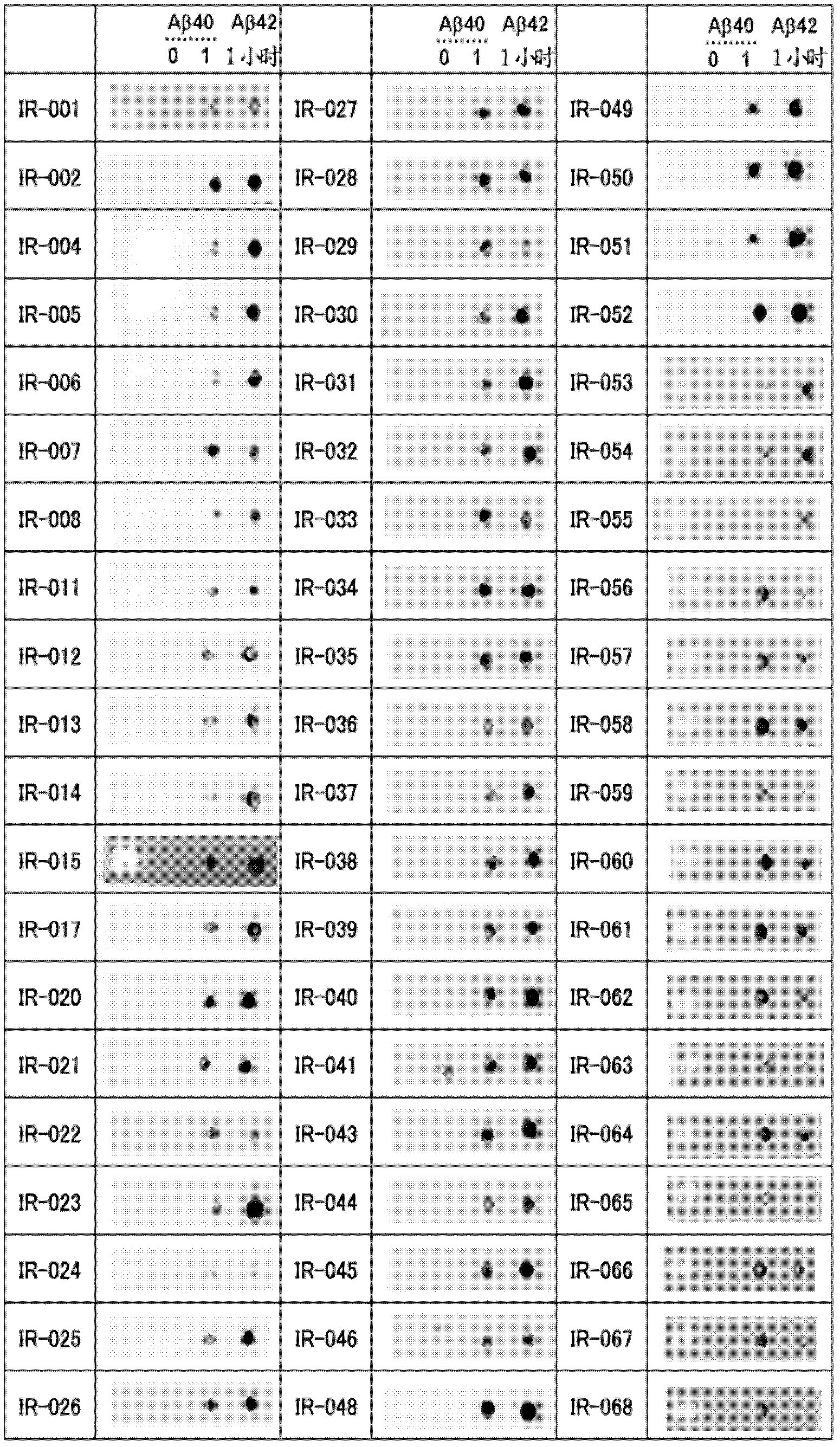 Antibodies that specifically bind to A beta oligomers and use thereof