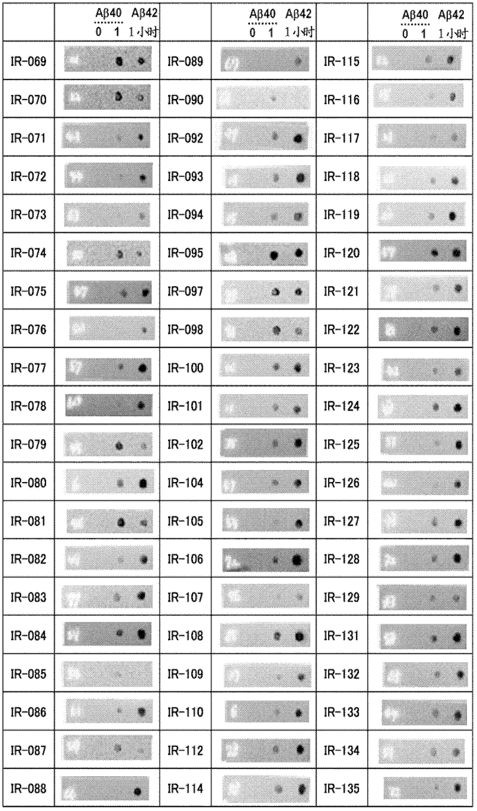 Antibodies that specifically bind to A beta oligomers and use thereof