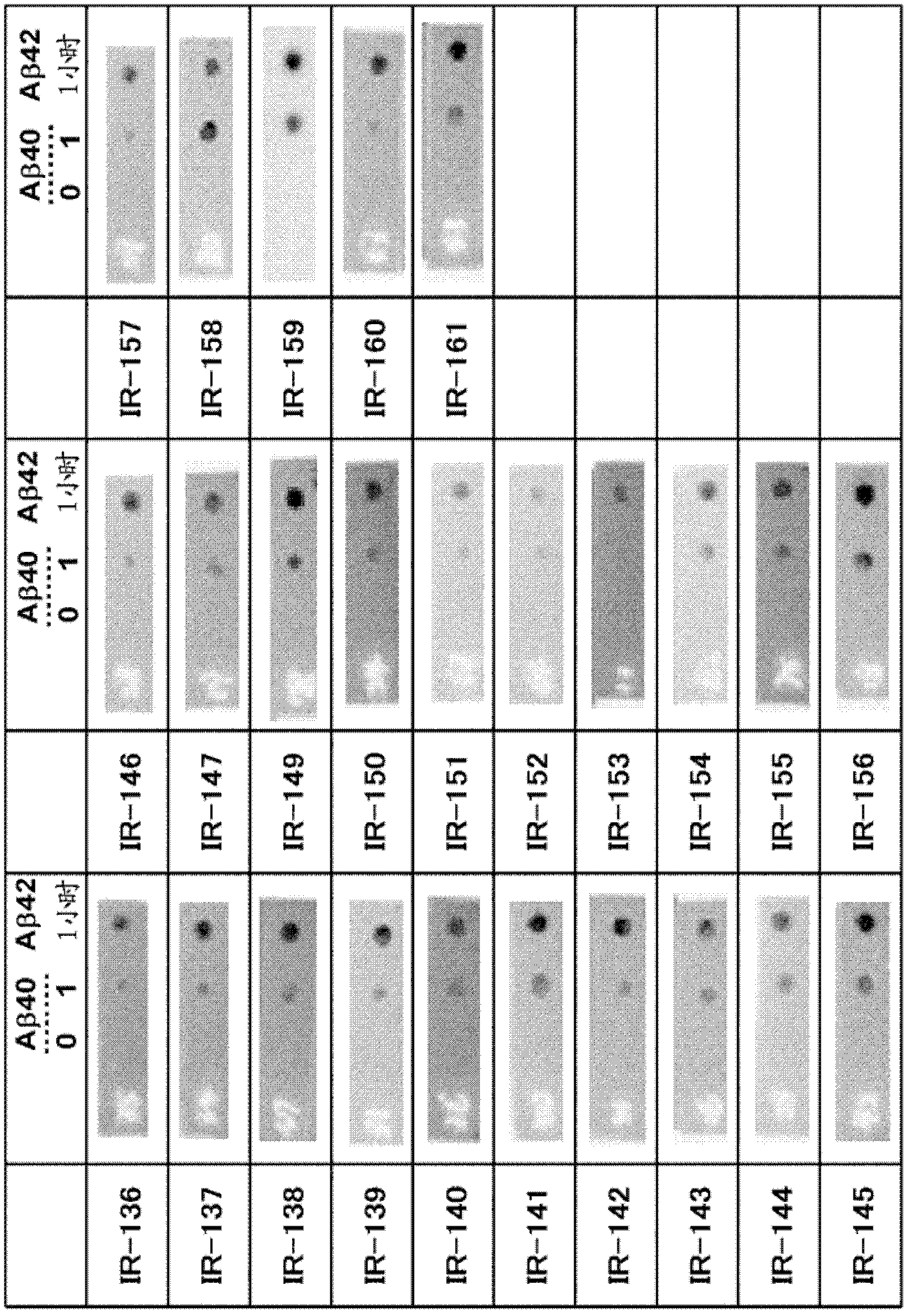 Antibodies that specifically bind to A beta oligomers and use thereof