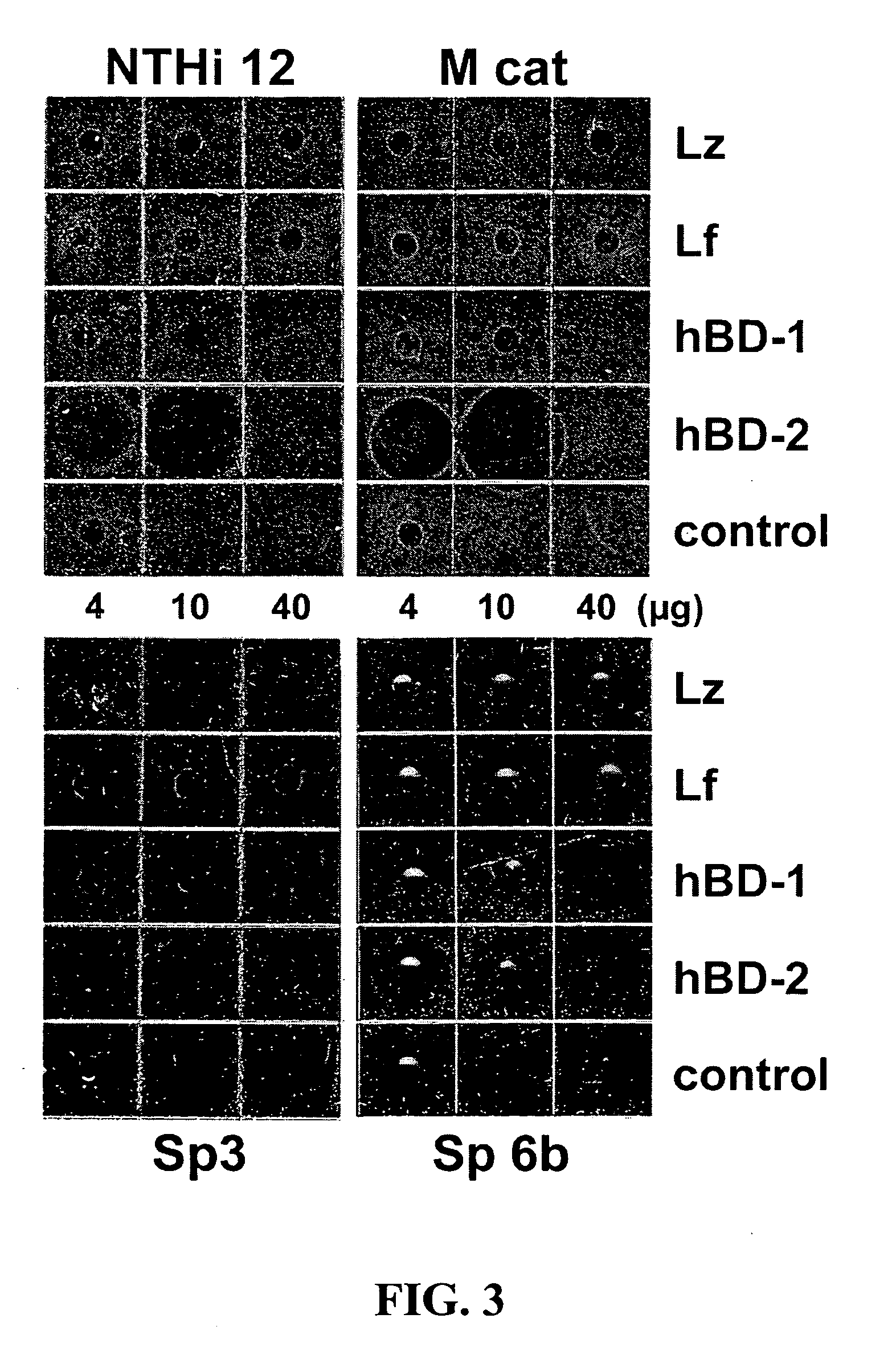 Use of antimicrobial proteins and peptides for the treatment of otitis media and paranasal sinusitis