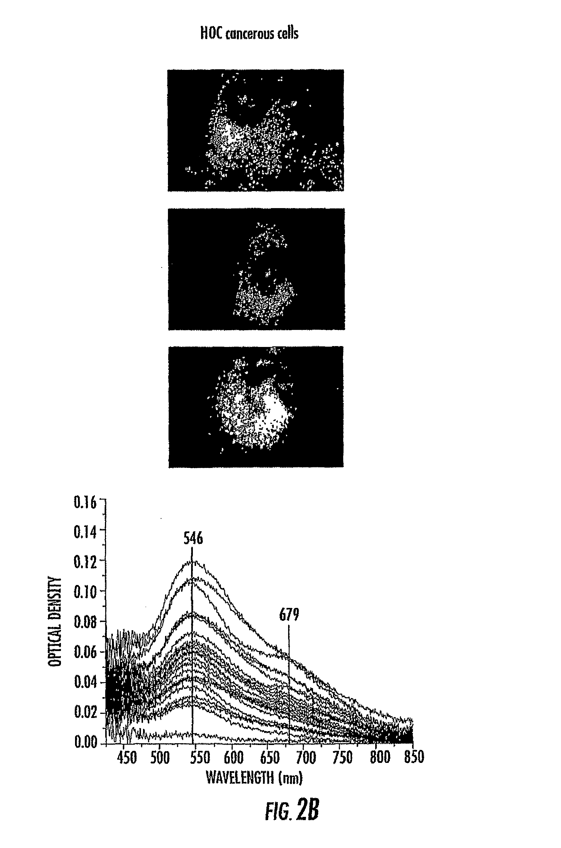 Shape tunable plasmonic nanoparticles