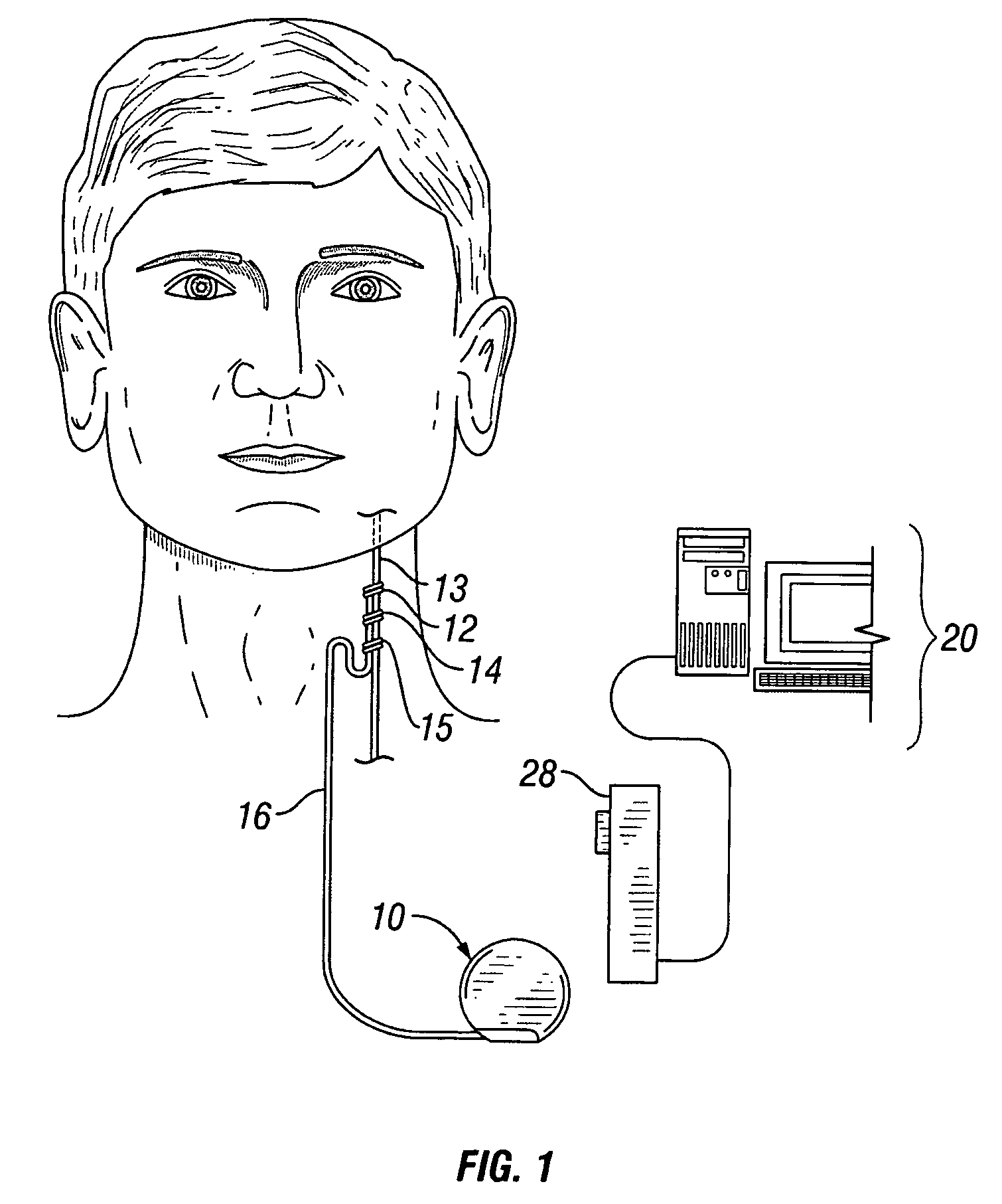 Implantable medical device with reconfigurable non-volatile program