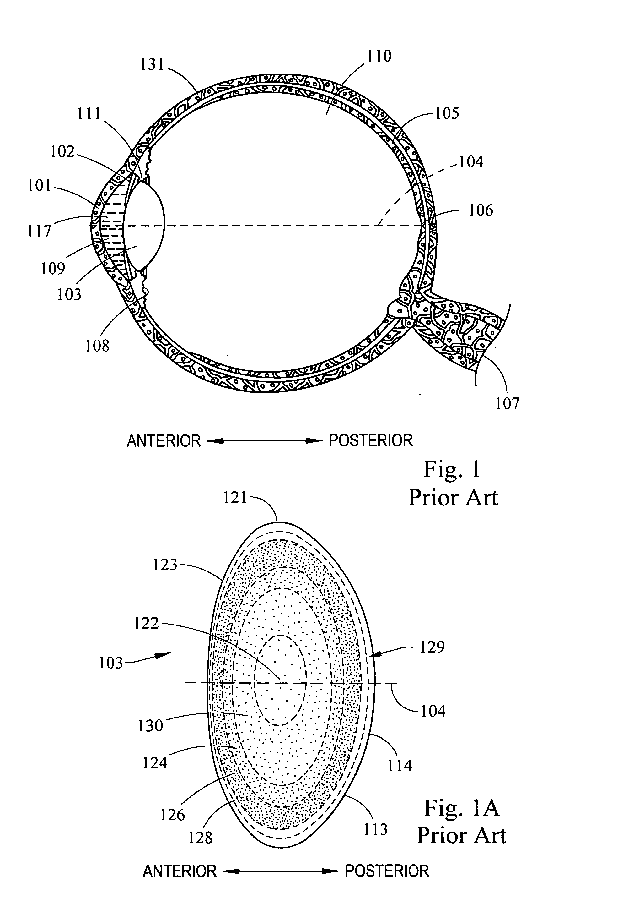 System and method for providing the shaped structural weakening of the human lens with a laser