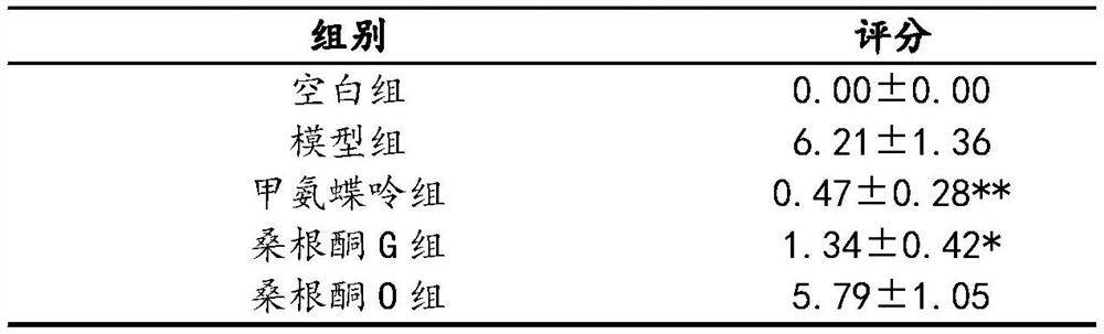 Application of Sanggenone G in preparation of drugs for treating psoriasis