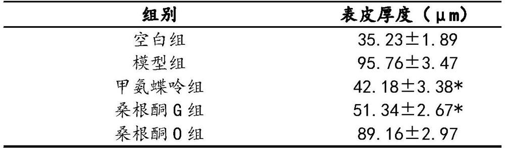 Application of Sanggenone G in preparation of drugs for treating psoriasis