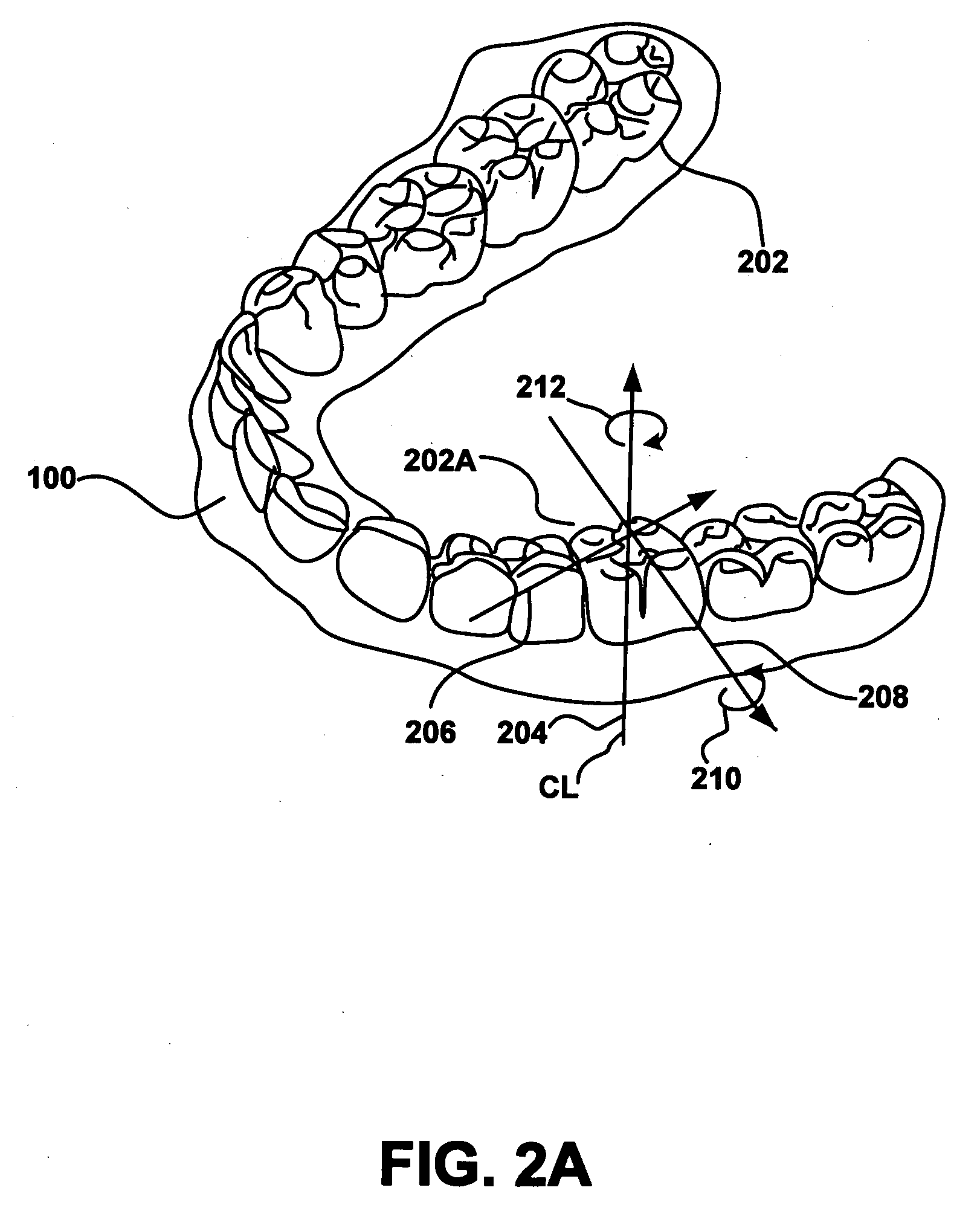 Method and system for improving dental esthetics