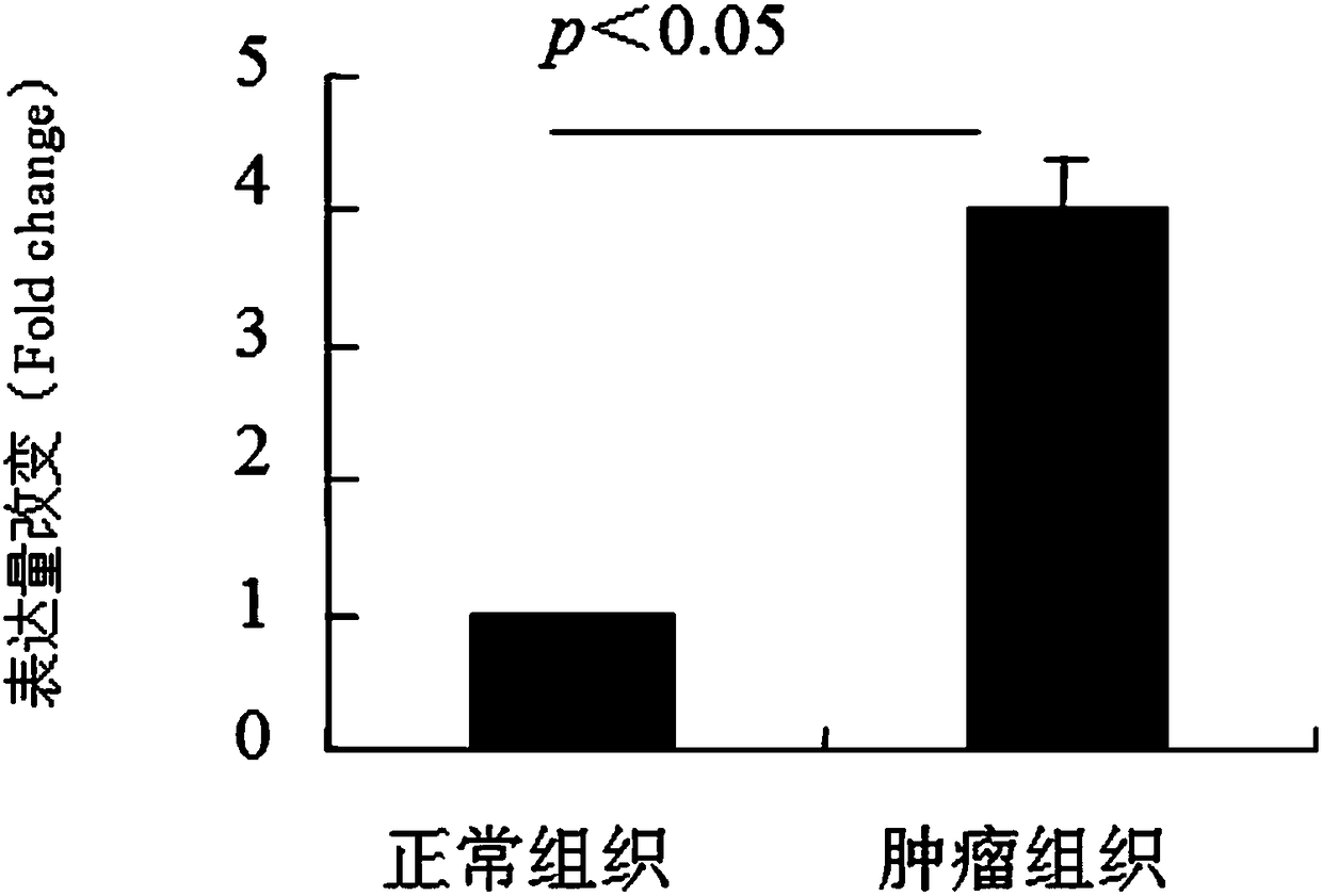 Application, kit and detection method of novel molecular marker non-coding RNA LINC00671 for prognosis of kidney cancer