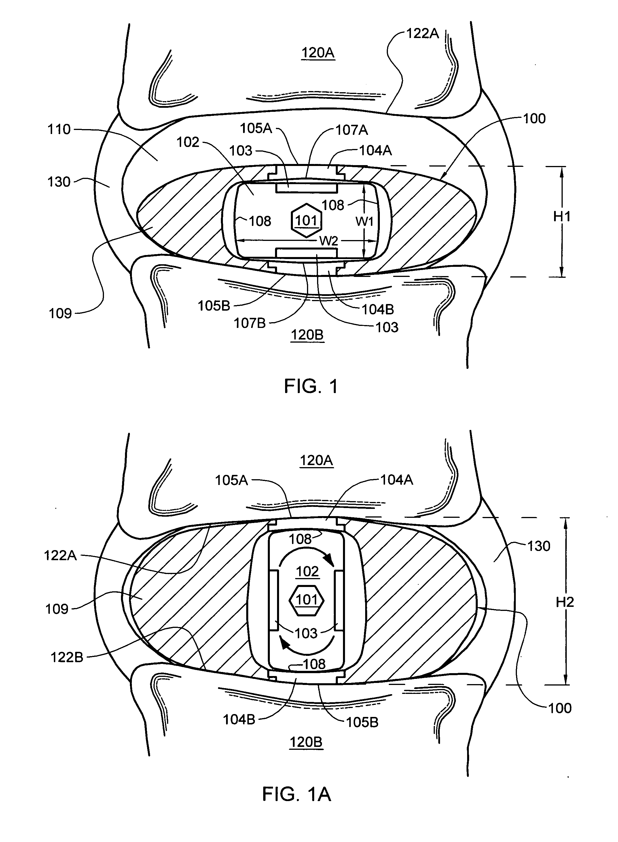 Intervertebral disc nucleus replacement implants and methods