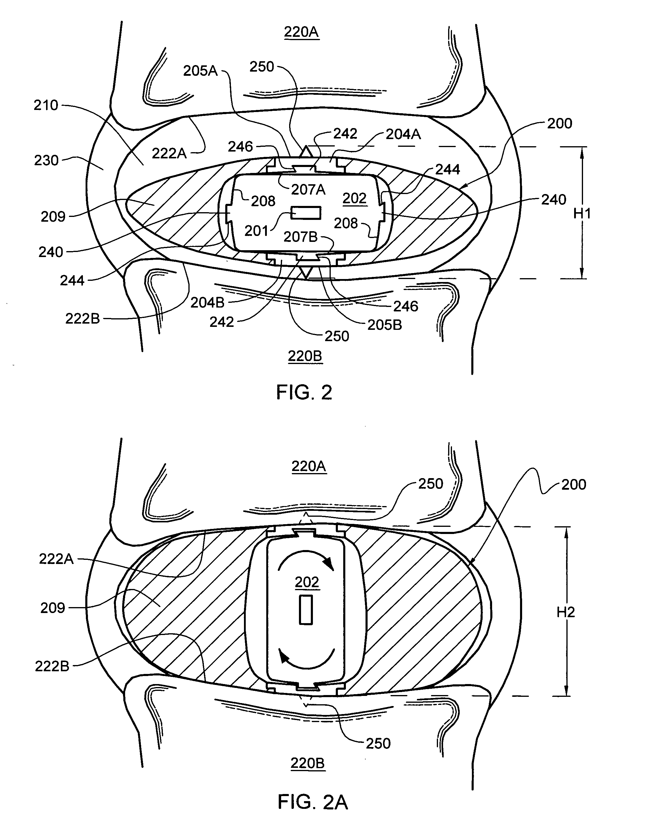 Intervertebral disc nucleus replacement implants and methods