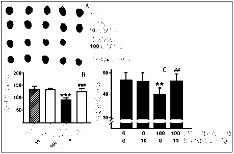 Application of glycyrrhizic acid in preparation of sunitinib malate cardiotoxicity reduction drug