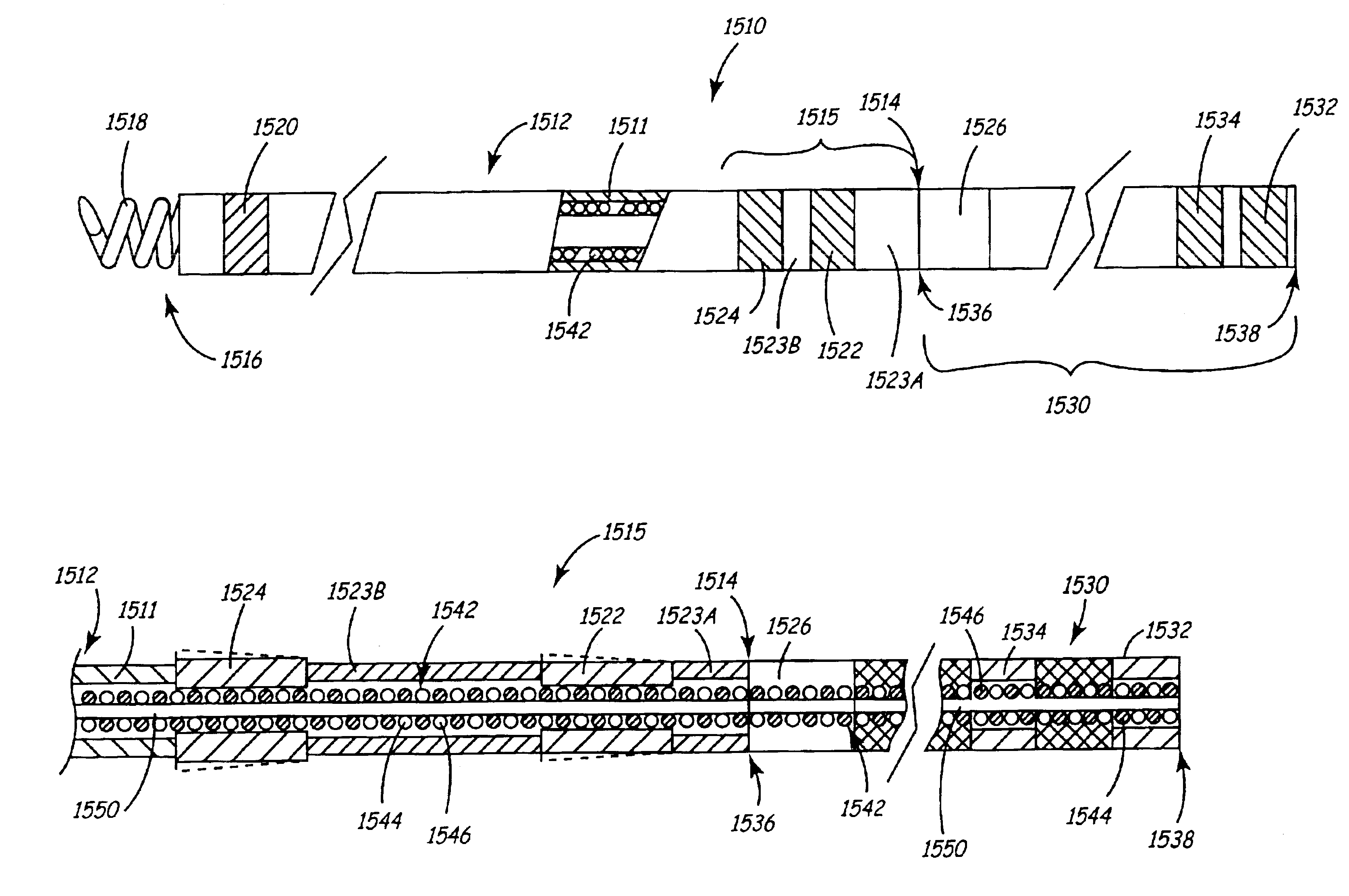 Medical lead extension and connection system