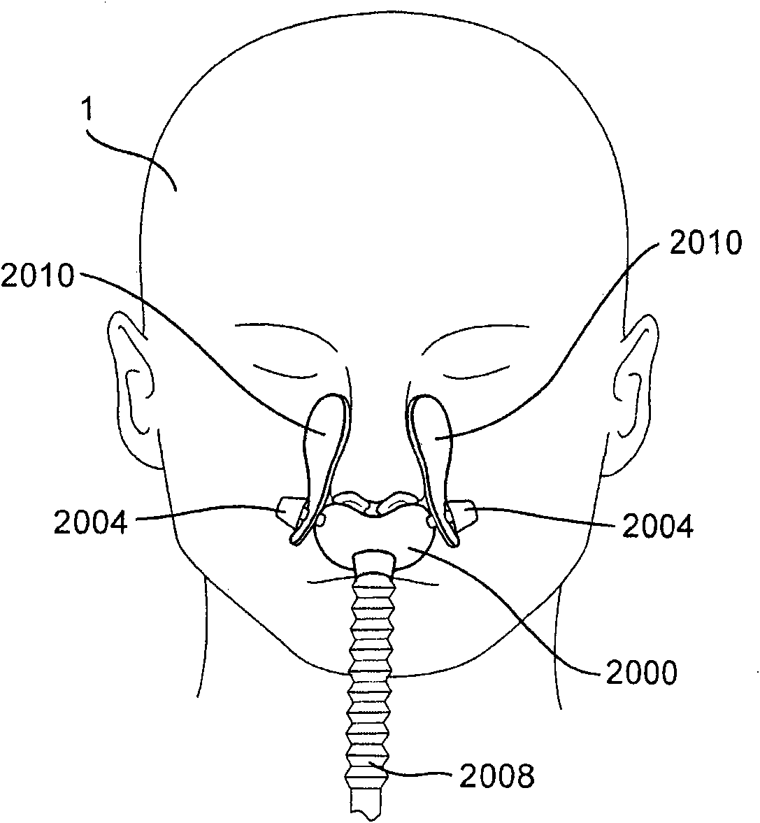 Patient interface systems