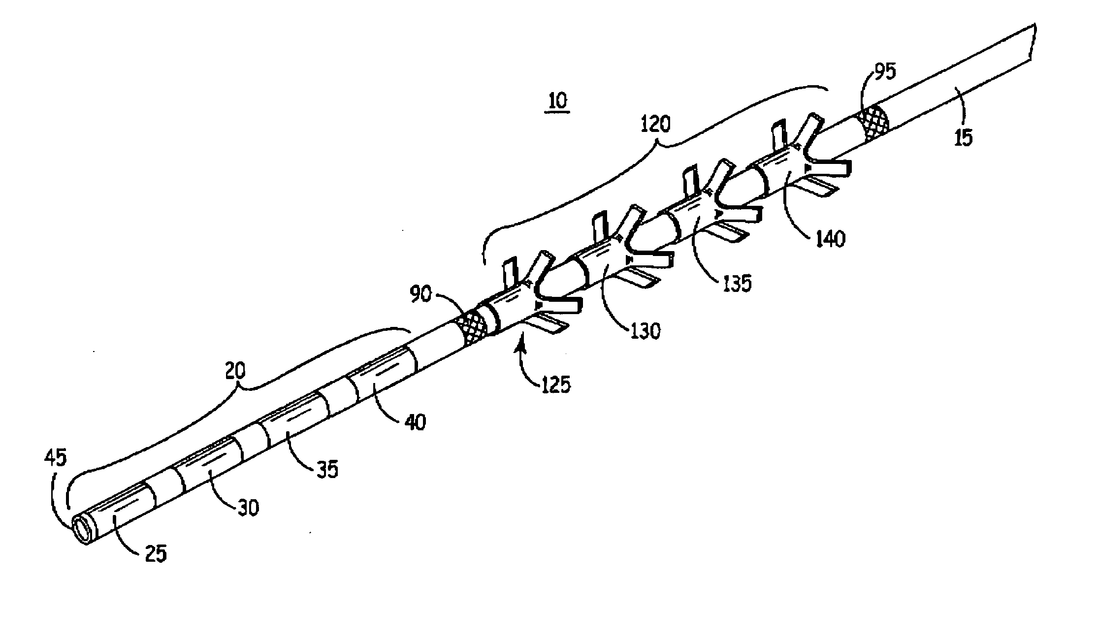 Implantable medical electrical stimulation lead fixation method and apparatus