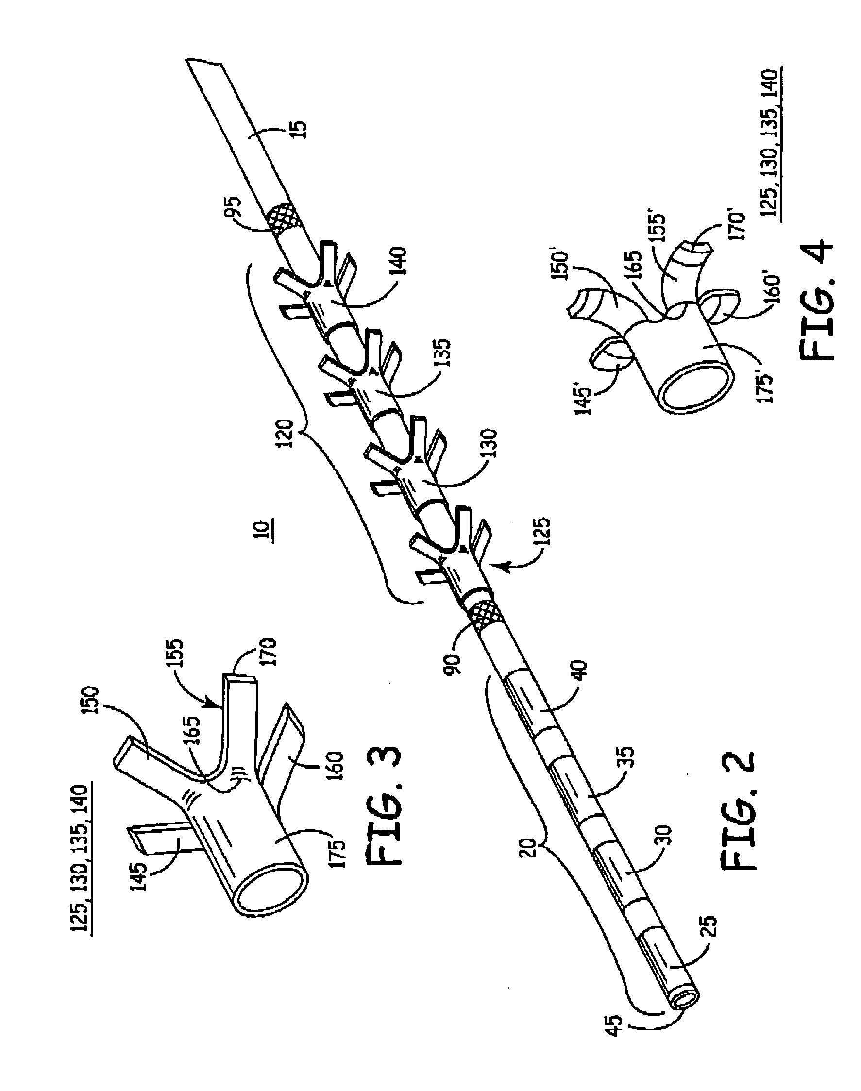 Implantable medical electrical stimulation lead fixation method and apparatus