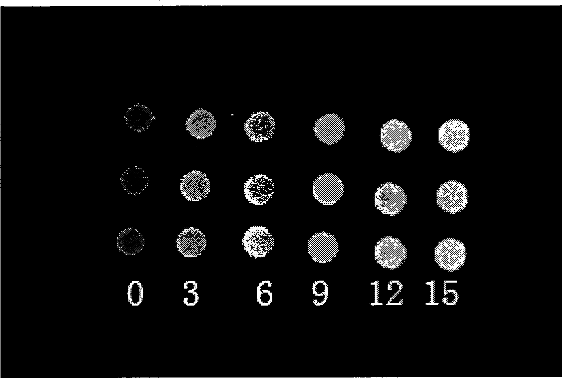 X-ray developing calcium phosphate cement and preparation method and application thereof