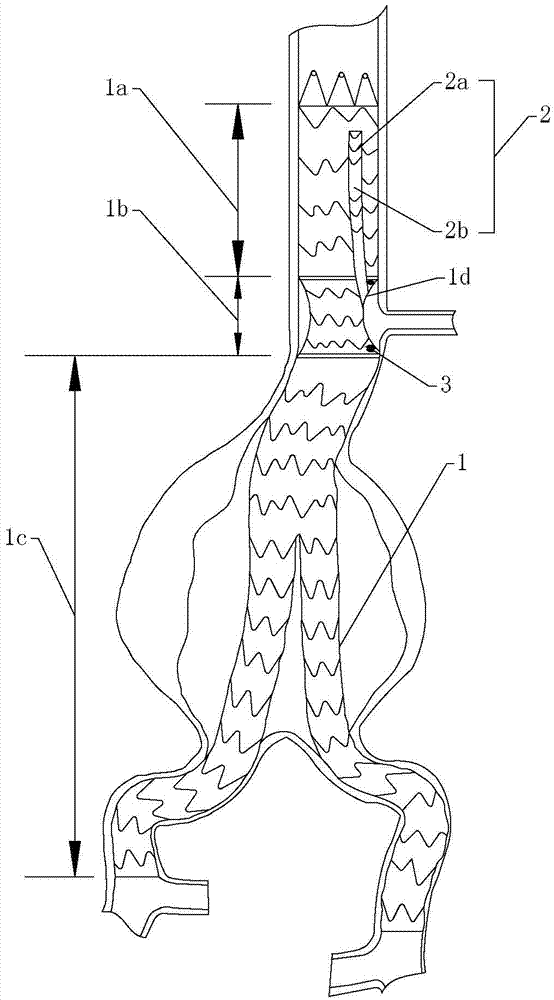 Aorta covered stent with chimney stent supporting pipe