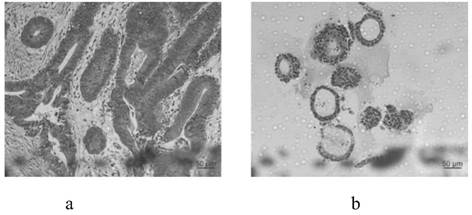 Culture method for colorectal cancer organoids and culture solution