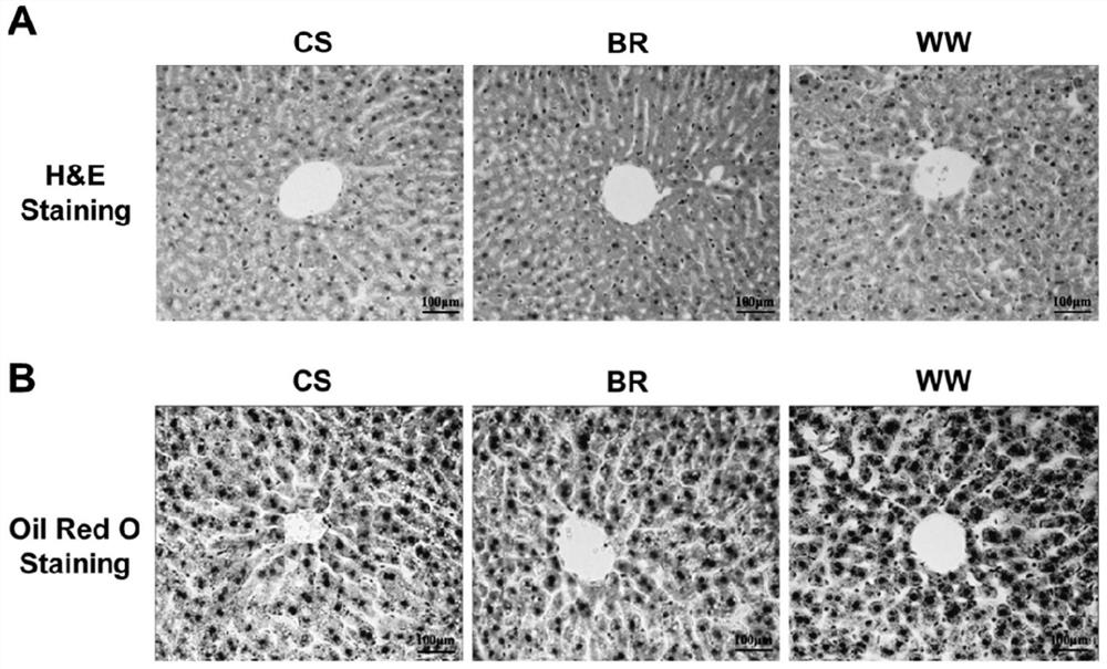 miRNA markers of lipid synthesis capacity under whole grain diet