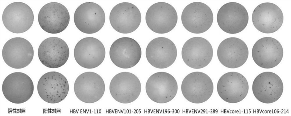 Amplification method of polyclonal anti-HBV immune cells