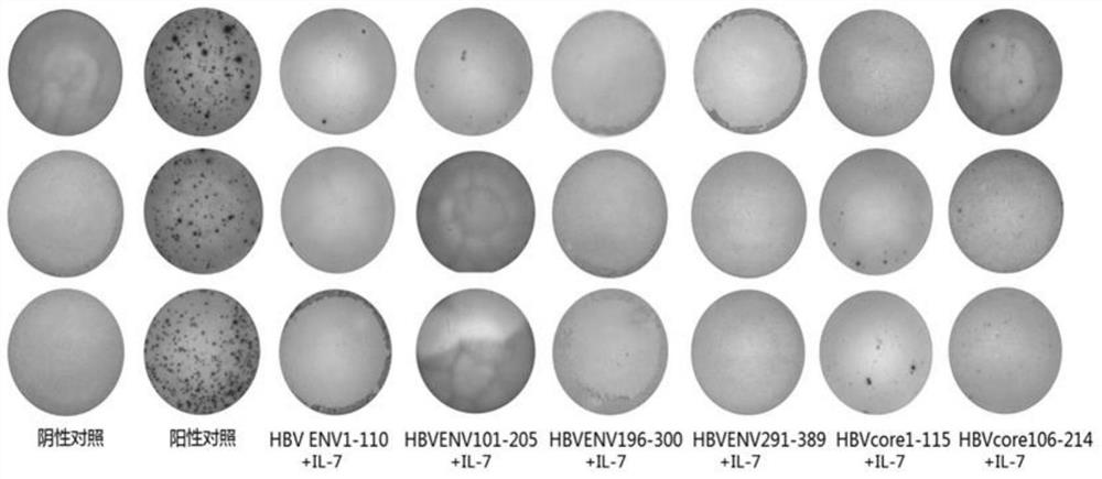 Amplification method of polyclonal anti-HBV immune cells